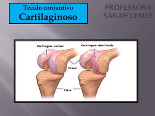 Tecido conjuntivo
Cartilaginoso
 