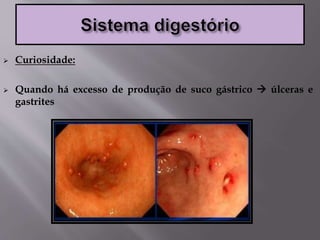  Curiosidade:
 Quando há excesso de produção de suco gástrico  úlceras e
gastrites
 