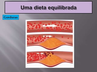 Gorduras
 