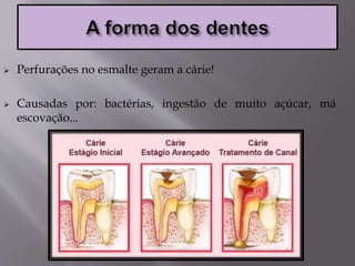  Perfurações no esmalte geram a cárie!
 Causadas por: bactérias, ingestão de muito açúcar, má
escovação...
 
