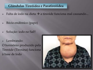 Glândulas Tireóidea e Paratireóidea
 Falta de iodo na dieta  a tireoide funciona mal causando...
 Bócio endêmico (papo)
 Solução: iodo no Sal!!
 Lembrando:
O hormônio produzido pela
Tireoide (Tiroxina) funciona
à base de Iodo
 