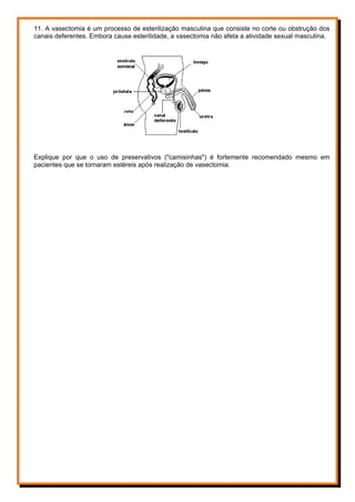 11. A vasectomia é um processo de esterilização masculina que consiste no corte ou obstrução dos
canais deferentes. Embora cause esterilidade, a vasectomia não afeta a atividade sexual masculina.
Explique por que o uso de preservativos ("camisinhas") é fortemente recomendado mesmo em
pacientes que se tornaram estéreis após realização de vasectomia.
 