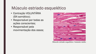 Músculo estriado esquelético
• Contração VOLUNTÁRIA
(SN somático);
• Responsável por todas as
ações conscientes;
• Responsável pela
movimentação dos ossos;
Músculo estriado esquelético. Aumento médio
 