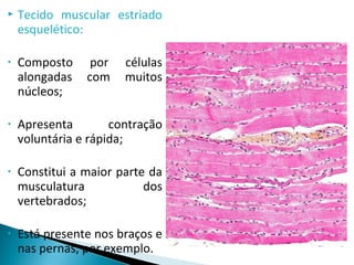  Tecido muscular estriado
esquelético:
• Composto por células
alongadas com muitos
núcleos;
• Apresenta contração
voluntária e rápida;
• Constitui a maior parte da
musculatura dos
vertebrados;
• Está presente nos braços e
nas pernas, por exemplo.
 