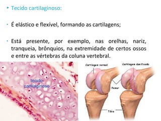 Tecido cartilaginoso:
• É elástico e flexível, formando as cartilagens;
• Está presente, por exemplo, nas orelhas, nariz,
tranqueia, brônquios, na extremidade de certos ossos
e entre as vértebras da coluna vertebral.
 