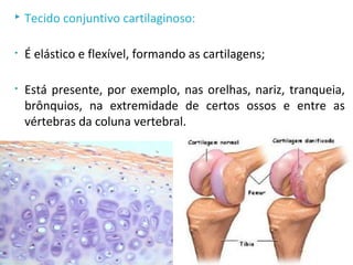  Tecido conjuntivo cartilaginoso:
• É elástico e flexível, formando as cartilagens;
• Está presente, por exemplo, nas orelhas, nariz, tranqueia,
brônquios, na extremidade de certos ossos e entre as
vértebras da coluna vertebral.
 