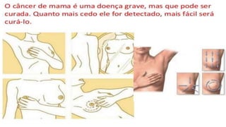 8 ano reprodução E  sistema reprodutor