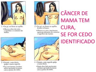 CÂNCER DE
MAMA TEM
CURA,
SE FOR CEDO
IDENTIFICADO
 