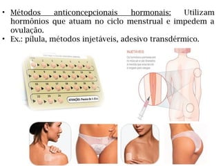 • Métodos anticoncepcionais hormonais: Utilizam
hormônios que atuam no ciclo menstrual e impedem a
ovulação.
• Ex.: pílula, métodos injetáveis, adesivo transdérmico.
 