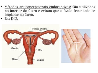 • Métodos anticoncepcionais endoceptivos: São utilizados
no interior do útero e evitam que o óvulo fecundado se
implante no útero.
• Ex.: DIU.
 