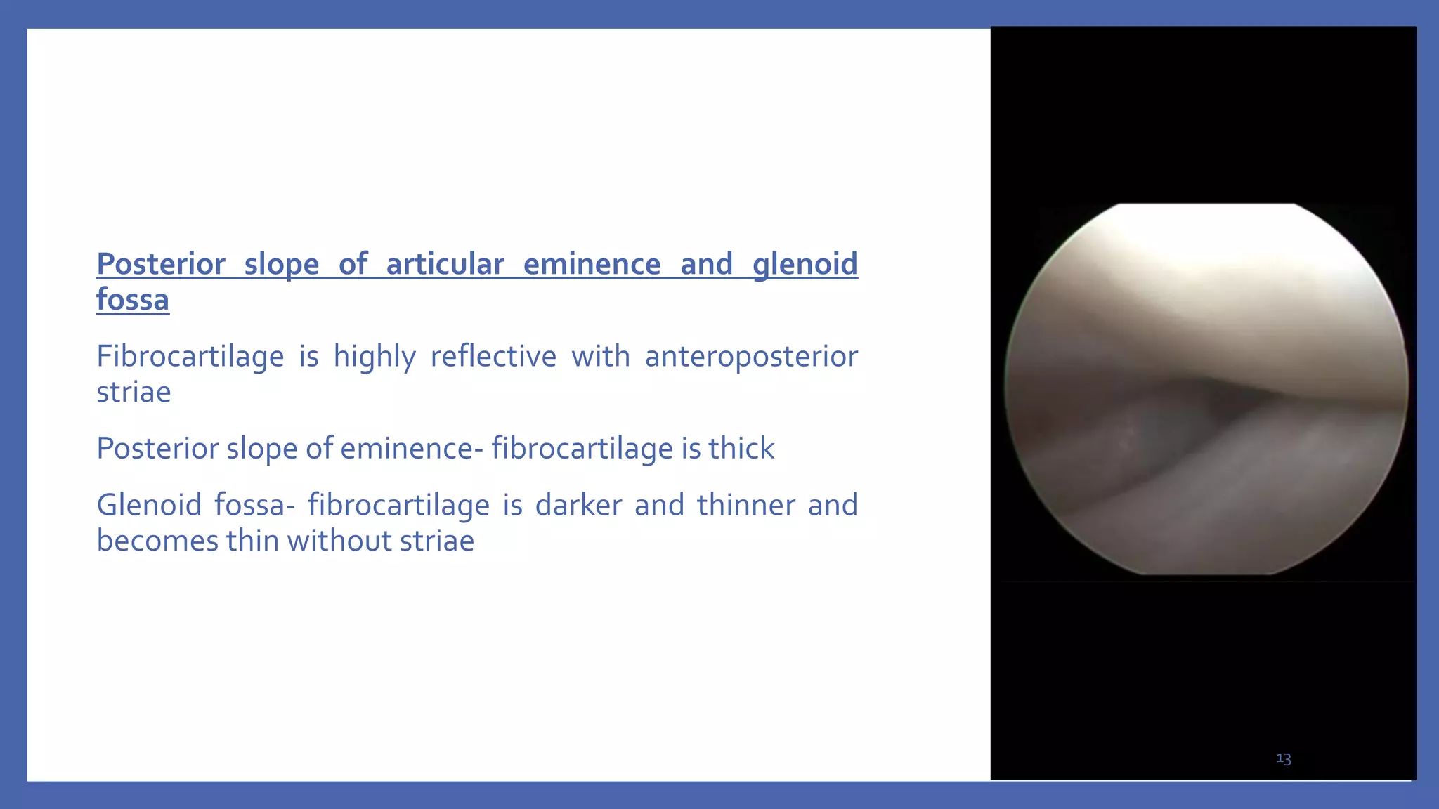 8 ARTHROSCOPY IN TMJ CONDITIONS seminar 8.pptx