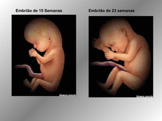 Embrião de 15 Semanas Embrião de 23 semanas
 