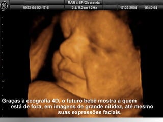 Graças à ecografia 4D, o futuro bebê mostra a quemGraças à ecografia 4D, o futuro bebê mostra a quem
está de fora, em imagens de grande nitidez, até mesmoestá de fora, em imagens de grande nitidez, até mesmo
suas expressões faciais.suas expressões faciais.
 