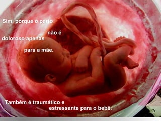 Sim, porque o partoSim, porque o parto
não énão é
doloroso apenasdoloroso apenas
para a mãe.para a mãe.
Também é traumático eTambém é traumático e
estressante para o bebê.estressante para o bebê.
 