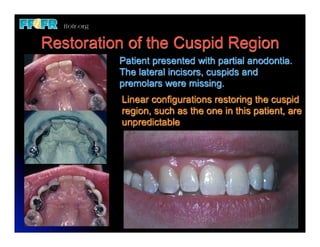 Automorphic Cuspidal Biomechanics and Treatment Planning | PDF | Dental Health | Diseases ...