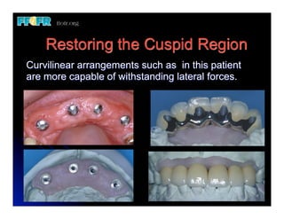 Biomechanics and Treatment Planning | PDF | Dental Health | Diseases ...
