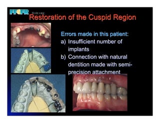 Biomechanics and Treatment Planning | PDF | Dental Health | Diseases ...