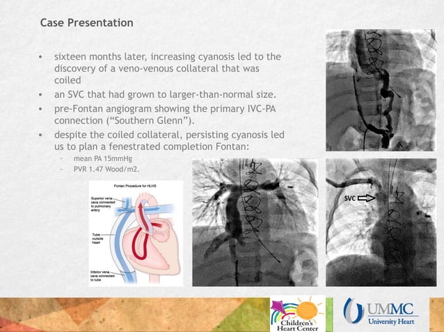 PCICS reverse staging | PPT