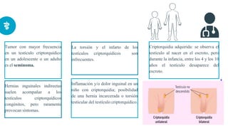 Tumor con mayor frecuencia
en un testículo criptorquídico
en un adolescente o un adulto
es el seminoma.
1 0
Hernias inguinales indirectas
suelen acompañar a los
testículos criptorquídicos
congénitos, pero raramente
provocan síntomas.
La torsión y el infarto de los
testículos criptorquídicos son
infrecuentes.
Inflamación y/o dolor inguinal en un
niño con criptorquidia; posibilidad
de una hernia incarcerada o torsión
testicular del testículo criptorquídico.
Criptorquidia adquirida: se observa el
testículo al nacer en el escroto, pero
durante la infancia, entre los 4 y los 10
años el testículo desaparece del
escroto.
 