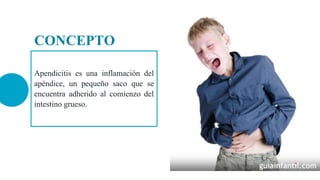 Apendicitis es una inflamación del
apéndice, un pequeño saco que se
encuentra adherido al comienzo del
intestino grueso.
CONCEPTO
 