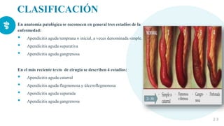CLASIFICACIÓN
En anatomía patológica se reconocen en general tres estadios de la
enfermedad:
• Apendicitis aguda temprana o inicial, a veces denominada simple.
• Apendicitis aguda supurativa
• Apendicitis aguda gangrenosa
En el más reciente texto de cirugia se describen 4 estadios:
• Apendicitis aguda catarral
• Apendicitis aguda flegmonosa y úlceroflegmonosa
• Apendicitis aguda supurada
• Apendicitis aguda gangrenosa
2 3
 