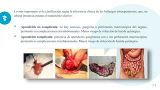 Lo más importante es la clasificación según la relevancia clínica de los hallazgos intraoperatorios, que, en
última instancia, pautan el tratamiento ulterior:
• Apendicitis no complicada: no hay necrosis, gangrena o perforación macroscópica del órgano,
peritonitis ni complicaciones extraabdominales. Menor riesgo de infección de herida quirúrgica.
• Apendicitis complicada: presencia de apendicitis gangrenosa con o sin perforación macroscópica,
peritonitis o complicaciones extrabdominales. Mayor riesgo de infección de herida quirúrgica.
2 4
 