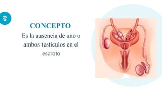 CONCEPTO
Es la ausencia de uno o
ambos testículos en el
escroto
 
