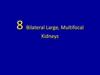 8 Bilateral Large, Multifocal
Kidneys
 
