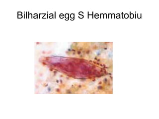 Bilharzial egg S Hemmatobiu
 