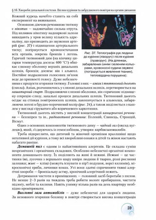 Кожний курець начебто ставить на собі
експеримент на виживання.
Основною діючою речовиною тютюну
є нікотин — надзвичайно сильна отрута.
Під впливом нікотину надниркові залози
викидають у кров велику кількість адре­
наліну, що призводить до звуження арте­
рій (рис. 37) і підвищення артеріального
тиску; погіршується кровопостачання
всіх органів, зокрема бронхів і легень.
Гарячий тютюновий дим (на кінчику ци­
гарки температура досягає 600 °С!) обпі­
кає слизову оболонку верхніх дихальних
шляхів, бронхів; досягає він і альвеол.
Постійне подразнення голосових зв’язок
веде до хрипкості голосу. Дуже небезпеч­
ними є продукти згоряння тютюну. Головні з них —аміак і тютюновий дьоготь
(смола). Аміак, розчиняючись у слизові дихальних шляхів, перетворюється на
нашатирний спирт. Подразнюючи слизові оболонки, він спричиняє підвище­
ну секрецію слизу, запальні процеси дихальних шляхів. Тютюновий дьоготь
осідає на стінках повітроносних шляхів, накопичується в альвеолах, забарв­
люючи легені в брудно-коричневий колір (рис. 34), а також виділяється з каш­
лем у вигляді сіруватого або коричневого харкотиння.
Тютюновий дьоготь містить у високій концентрації канцерогенні речови­
ни —бензпірен та ін., радіоактивні речовини: Полоній, Свинець, Стронцій,
Вісмут.
Один з основних компонентів тютюнового диму —чадний газ (оксид вуг­
лецю), який, з’єднуючись із гемоглобіном, утворює карбоксигемоглобін.
Треба підкреслити, що дитячий та жіночий організми вразливіші щодо
негативної дії куріння, а тому всі хворобливі ознаки в дітей та жінок настають
набагато раніше.
Домашній пил є одним із найактивніших алергенів. Це складна суміш
неорганічних і органічних складових. Особливо небезпечні органічні компо­
ненти домашнього пилу. їх поділяють на живі й неживі. Неживі — це час­
тинки їжі, лусочки з верхнього шару шкіри людини й тварин, різні рослинні
залишки; живі —кліщі (можуть існувати в пір’ї подушок, ворсі килимів), мі­
кроскопічні гриби, личинки комах. Усі вони здатні спричиняти тяжкі алер­
гічні хвороби —бронхіальну астму, хронічний алергічний нежить.
Дотримання чистоти в приміщеннях —головний засіб боротьби з пилом.
Не менше 2-3 разів на тиждень треба робити вологе прибирання, чистити
підлогу, меблі та килими. Навіть узимку кілька разів на день квартиру необ­
хідно провітрювати.
Вихлопні гази автомобілів — дуже небезпечні для здоров’я людини.
За неповного згоряння бензину в повітрі створюється висока концентрація
§ 16. Хвороби дихальної системи. Вплив куріння та забрудненого повітря наорганидихання
Рис. 37. Теплографія рук людини
до куріння (ліворуч) і після куріння
(праворуч). (На ділянках,
забарвлених синім і зеленим кольо­
рами, кровоносні судини звужені
(погіршується живлення тканин),
тепловіддача порушена).
59
 