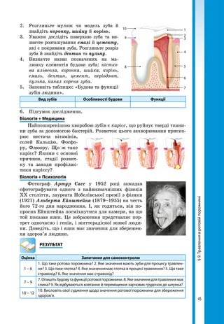 45
§9.Травленнявротовійпорожнині
2. 	 Розгляньте муляж чи модель зуба й
знайдіть коронку, шийку й корінь.
3. 	 Уважно дослідіть поверхню зуба та ви­
значте розташування емалі й цементу,
які є покривами зуба. Розгляньте розріз
зуба й знайдіть дентин та пульпу.
4. 	Визначте назви позначених на ма-
люнку елементів будови зуба: кістко-
ва альвеола, коронка, шийка, корінь,
емаль, дентин, цемент, періодонт,
пульпа, канал кореня зуба.
5. 	 Заповніть таблицю: «Будова та функції
зубів людини».
Вид зубів Особливості будови Функції
6. 	 Підсумок дослідження.
Біологія + Медицина
Найпоширенішою хво­робою зубів є карієс, що руйнує тверді ткани-
ни зуба за допомогою бактерій. Розвиток цього захворювання при­ско­
рює нестача вітамінів,
солей Кальцію, Фосфо-
ру, Флюору. Що ж таке
карієс? Якими є основні
причини, стадії розвит-
ку та заходи профі­лак­
тики карієсу?
Біологія + Психологія
Фотограф Артур Сасс у 1952 році зажадав
сфотографувати одного з найвизначніших фізиків
ХХ століття, лауреата Нобелівської премії з фізики
(1921) Альберта Ейнштейна (1879–1955) на честь
його 72-го дня народження. І, як годиться, він по-
просив Ейнштейна посміхнутися для камери, на що
той показав язик. Це зображення представляє пор-
трет одночасно і генія, і життєрадісної живої люди-
ни. Доведіть, що і язик має значення для збережен-
ня здоров’я людини.
	РЕЗУЛЬТАТ
Оцінка Запитання для самоконтролю
1 – 6
1. Що таке ротова порожнина? 2. Яке значення мають зуби для процесу травлен-
ня? 3. Що таке глотка? 4. Яке значення має глотка в процесі травлення? 5. Що таке
стравохід? 6. Яке значення має стравохід?
7 – 9
7.Опишітьбудовутафункціїротовоїпорожнини.8.Якезначеннядлятравленнямає
слина? 9. Як відбуваються ковтання й переміщення харчових грудочок до шлунка?
10 – 12
10. Висловіть свої судження щодо значення ротової порожнини для збереження
здоров’я.
7
6
5
4
3
2
1
9
8
10
 