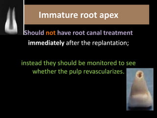 Immature root apex 
Should not have root canal treatment 
immediately after the replantation; 
instead they should be monitored to see 
whether the pulp revascularizes. 
 