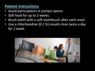 Patient instructions 
• Avoid participation in contact sports. 
• Soft food for up to 2 weeks. 
• Brush teeth with a soft toothbrush after each meal. 
• Use a chlorhexidine (0.1 %) mouth rinse twice a day 
for 1 week. 
 