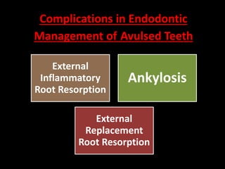 Complications in Endodontic 
Management of Avulsed Teeth 
External 
Inflammatory 
Root Resorption 
Ankylosis 
External 
Replacement 
Root Resorption 
 