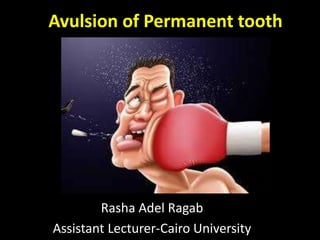 Avulsion of Permanent tooth 
Rasha Adel Ragab 
Assistant Lecturer-Cairo University 
 