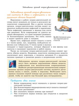 Заболевание органов опорно-двигательной системы
111
Заболевания органов опорно-двигатель-
ной системы в связи с инфекциями и на-
рушением обмена веществ
Нарушения в работе опорно-двигательной си-
стемы могут возникать не только в результате ме-
ханических повреждений. Как и другие системы
органов, опорно-двигательная система может по-
ражаться возбудителями инфекций и паразитами.
Часто инфекции проникают в мышцы или кости
при ранениях. Если повреждение не удается на-
дежно обеззаразить, то в ране начинают развивать-
ся болезнетворные организмы. Это очень опасно
и может привести даже к гангрене.
Кроме того, инфекция может попасть в кости
и с током крови, как, например, возбудители си-
филиса или туберкулеза. С током крови в мышцы
попадают и черви-паразиты, которые образуют в них финны или
капсулы и вызывают нарушения в работе мышц.
Также на состояние опорно-двигательной системы влияют про-
цессы обмена веществ. Например, недостаток минеральных веществ
увеличивает риск переломов, а нехватка витамина D в продуктах
питания приводит к развитию рахита и искривлению костей.
Заболевания органов опорно-двигательной системы
могут быть вызваны нарушениями обмена веществ,
инфекциями или механическими повреждениями.
Наиболее распространенными механическими повреж-
дениями органов опорно-двигательной системы являются растя-
жения мышц и связок, ушибы и переломы. Необходимо знать
правила оказания первой помощи при различных типах повреж-
дений, чтобы не нанести еще больший вред пострадавшему.
Проверьте свои знания
1. Какие повреждения могут возникать в органах опорно-дви-
гательной системы?
2. Как болезнетворные микроорганизмы могут попасть в мышцы?
3. Что такое растяжение?
4. Как оказывать первую помощь при вывихе?
5*. Чем отличается первая помощь при открытом и закрытом
переломах?
Рис. 30.1. Наложение шины
при переломе руки (а)
и ноги (б)
а
б
 