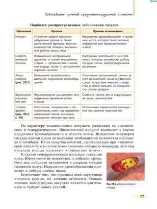 Заболевания органов сердечно-сосудистой системы
77
Наиболее распространенные заболевания сосудов
Заболевание Признаки Причины возникновения
Инсульт Снижение уровня сознания,
нарушение зрения, а также
двигательной функции верхних
конечностей, походки, нормаль-
ной работы мышц лица
Нарушение кровообращения в голов-
ном мозге, которое было вызвано
инфарктом или кровоизлиянием
в  мозг
Гиперто-
ническая
болезнь
Повышенное артериальное
давление, в случае выраженных
стадий — органические измене-
ния сердца, почек и центральной
нервной системы
Нарушение деятельности центров
мозга, которые регулируют работу
сосудов, почек, нейрогуморальной
регуляции
Атеро-
склероз
(рис.  20.1)
Повышение артериального
давления, нарушение кровообра-
щения
Уплотнение артериальной стенки за
счет разрастания ткани внутренней
среды вследствие жирового веще-
ства и солей Кальция на поверхно-
сти стенки артерии
Варикозное
расшире-
ние вен
Неравномерное расширение вен,
нарушение движения крови
в венах
Слабость стенок вен и окружающих
их мышц конечностей
Тромбо-
флебит
(рис.  20.3,
с. 78)
Уплотнение, покраснение и бо-
лезненность кожи над варикозно
измененной веной, возможно
повышение температуры тела
Осложнение варикозного расшире-
ния вен нижних конечностей
По характеру возникновения инсульты разделяют на ишемиче-
ские и геморрагические. Ишемический инсульт возникает в случае
нарушения кровообращения в области мозга. Вследствие закупорки
сосудов клетки крови не получают необходимого количества кислоро-
да и погибают. Из-за сходства событий, происходящих при ишемиче-
ском инсульте и в случае возникновения инфаркта миокарда, этот вид
инсульта иногда называют «инфарктом мозга».
В случае геморрагического инсульта ситуация
иная. Имеет место не недостаток, а избыток крови.
Этот вид инсульта начинается с разрыва сосудов
головного мозга. Нарушение кровообращения при-
водит к гибели клеток мозга.
Вследствие того, что причины этих двух типов
инсульта разные, их лечение отличатся. Однако
лечение любой формы инсульта является длитель-
ным и требует много усилий.
Рис. 20.1. Атеросклероз
сосуда
 
