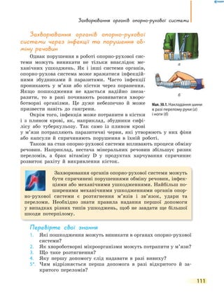 Захворювання органів опорно-рухової системи
111
Захворювання органів опорно-рухової
системи через інфекції та порушення об-
міну речовин
Однак порушення в роботі опорно-рухової сис-
теми можуть виникати не тільки внаслідок ме-
ханічних ушкоджень. Як і інші системи органів,
опорно-рухова система може вражатися інфекцій-
ними збудниками й паразитами. Часто інфекції
проникають у м’язи або кістки через поранення.
Якщо пошкодження не вдається надійно знеза-
разити, то в рані починають розвиватися хворо-
ботворні організми. Це дуже небезпечно й може
призвести навіть до гангрени.
Окрім того, інфекція може потрапити в кістки
і з плином крові, як, наприклад, збудники сифі-
лісу або туберкульозу. Так само із плином крові
у м’язи потрапляють паразитичні черви, які утворюють у них фіни
або капсули й спричиняють порушення в їхній роботі.
Також на стан опорно-рухової системи впливають процеси обміну
речовин. Наприклад, нестача мінеральних речовин збільшує ризик
переломів, а брак вітаміну D у продуктах харчування спричиняє
розвиток рахіту й викривлення кісток.
Захворювання органів опорно-рухової системи можуть
бути спричинені порушеннями обміну речовин, інфек-
ціями або механічними ушкодженнями. Найбільш по-
ширеними механічними ушкодженнями органів опор-
но-рухової системи є розтягнення м’язів і зв’язок, удари та
переломи. Необхідно знати правила надання першої допомоги
у випадках різних типів ушкоджень, щоб не завдати ще більшої
шкоди потерпілому.
перевірте свої знання
1. Які пошкодження можуть виникати в органах опорно-рухової
системи?
2. Як хвороботворні мікроорганізми можуть потрапити у м’язи?
3. Що таке розтягнення?
4. Яку першу допомогу слід надавати в разі вивиху?
5*. Чим відрізняється перша допомога в разі відкритого й за-
критого переломів?
Мал. 30.1. Накладання шини
в разі перелому руки (а)
і ноги (б)
а
б
 