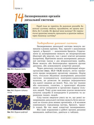 теМа 3
52
Захворювання дихальної системи
Захворювання дихальної системи можуть ви-
никати з різних причин. Так, трахеїт є запаленням
трахеї, а бронхіт — запаленням бронхів. Спричи-
нити ці захворювання можуть як мікроорганізми
(бактерії або віруси), так і деякі хімічні речовини
(алергени). Причиною низки захворювань дихаль-
ної системи також є дія мікроскопічних грибів.
Вони можуть або безпосередньо вражати органи
дихання, або зумовлювати алергічні реакції.
Через дихальну систему хвороботворні мікро-
організми (мал. 14.1–14.3) можуть легко прони-
кати прямо всередину організму людини. Окрім
того, оскільки збудники захворювань дихальної
системи поширюються повітряно-крапельним
шляхом, це дозволяє їм швидко передаватися
від однієї людини до іншої. Так, під час чхання
або кашляння, скажімо, у транспорті збудник
може легко потрапити в організми відразу кіль-
кох людей. Тому дуже важливо вчасно визначити
початок хвороби й попередити її розвиток та за-
раження інших людей.
Слід також звертати увагу на те, що деякі за-
хворювання дихальної системи можуть бути викли-
кані не тільки дією живих організмів, а й впливом
зовнішнього середовища (астма, бронхіт, трахе-
їт тощо). Це так звані алергічні захворювання.
Які саме порушення в роботі органів дихання
виникають найчастіше, дивіться в таблиці.
Перед тим як перейти до вивчення розладів ди-
хальної системи людини, пригадайте, які органи вхо-
дять до її складу. Які функції вона виконує? Які парази-
тичні організми можуть проникати в організм людини
через дихальну систему?
14Захворювання органів
дихальної системи
Мал. 14.1. Збудник грипу
Мал. 14.2. Збудник туберку-
льозу
Мал. 14.3. Збудник дифтерії
 
