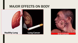 MAJOR EFFECTS ON BODY
Oral Cancer
 