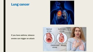 Lung cancer
If you have asthma, tobacco
smoke can trigger an attack
 