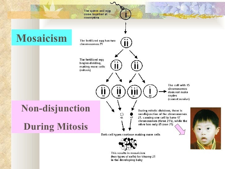 8 Chromosome Disorder