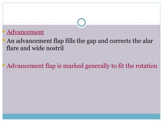 Advancement
An advancement flap fills the gap and corrects the alar
flare and wide nostril
Advancement flap is marked generally to fit the rotation
 
