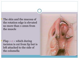 The skin and the mucosa of
the rotation edge is elevated
no more than 1-2mm from
the muscle
Flap – c – which during
incision is cut from lip but is
left attached to the side of
the columella
 