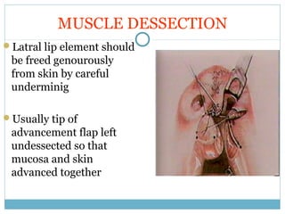 MUSCLE DESSECTION
Latral lip element should
be freed genourously
from skin by careful
underminig
Usually tip of
advancement flap left
undessected so that
mucosa and skin
advanced together
 