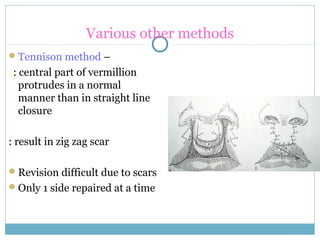 Various other methods
Tennison method –
s: central part of vermillion
protrudes in a normal
manner than in straight line
closure
: result in zig zag scar
Revision difficult due to scars
Only 1 side repaired at a time
 