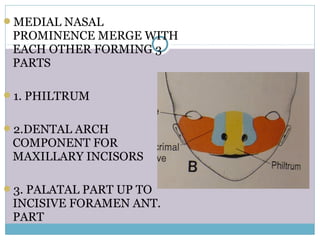 MEDIAL NASAL
PROMINENCE MERGE WITH
EACH OTHER FORMING 3
PARTS
1. PHILTRUM
2.DENTAL ARCH
COMPONENT FOR
MAXILLARY INCISORS
3. PALATAL PART UP TO
INCISIVE FORAMEN ANT.
PART
 