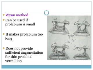 Wynn method
Can be used if
prolabium is small
It makes prolabium too
long
Does not provide
sufficient augmentation
for thin prolabial
vermillion
 