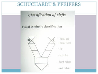 SCHUCHARDT & PFEIFERS
 