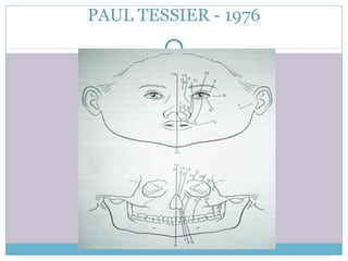 PAUL TESSIER - 1976
 